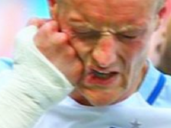 
	E nebun! :) Reactia lui Vardy dupa o ratare in meciul Angliei: si-a dat un pumn in fata cu mana la care are o fractura inca din toamna VIDEO
