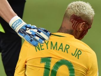 
	Imagini incredibile: Neymar, umplut de sange dupa ce a incercat sa-si umileasca un adversar! Ce i-a facut acesta
