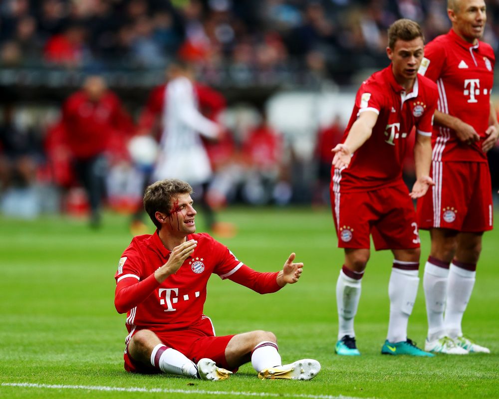 FOTO: Thomas Muller, plin de sange pe teren. Ce a patit jucatorul lui Bayern in ultimul meci_2