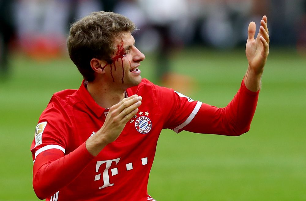 FOTO: Thomas Muller, plin de sange pe teren. Ce a patit jucatorul lui Bayern in ultimul meci_3