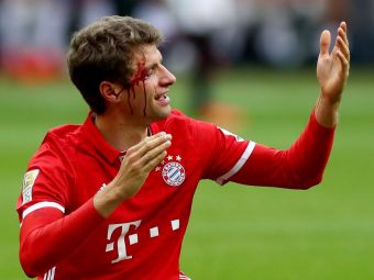 FOTO: Thomas Muller, plin de sange pe teren. Ce a patit jucatorul lui Bayern in ultimul meci