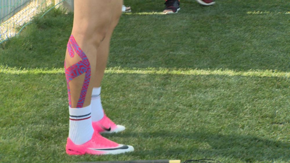 Cum arata piciorul lui Budescu dupa ruptura musculara si cand revine pe teren! FOTO_3