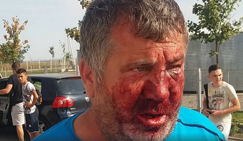 Imagini socante: un antrenor roman, umplut de sange la un meci din Liga a 4-a de rudele unui fotbalist: "L-au atacat 7-8 insi deodata"_2