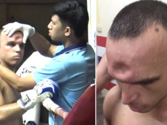 
	VIDEO INCREDIBIL: A aparut momentul loviturii care i-a facut unui luptator de Muay Thai o GAURA in cap 
