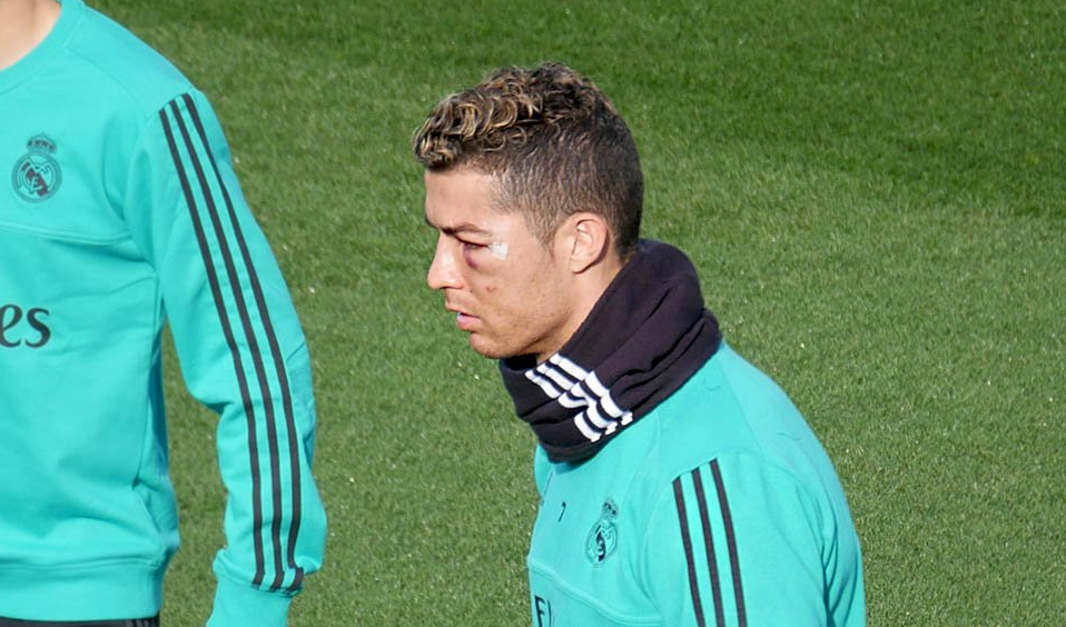 RONALDO, APARITIE SOC // Cum arata Cristiano Ronaldo dupa ce a iesit insangerat de pe teren la meciul cu Deportivo. FOTO_1