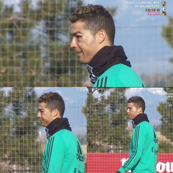 RONALDO, APARITIE SOC // Cum arata Cristiano Ronaldo dupa ce a iesit insangerat de pe teren la meciul cu Deportivo. FOTO_2
