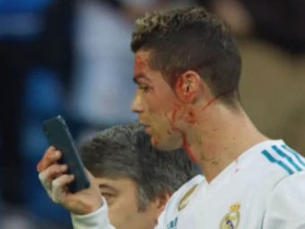 
	RONALDO, APARITIE SOC // Cum arata Cristiano Ronaldo dupa ce a iesit insangerat de pe teren la meciul cu Deportivo. FOTO
