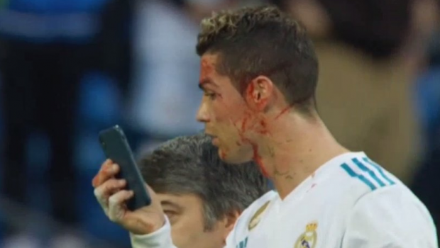 
	RONALDO, APARITIE SOC // Cum arata Cristiano Ronaldo dupa ce a iesit insangerat de pe teren la meciul cu Deportivo. FOTO
