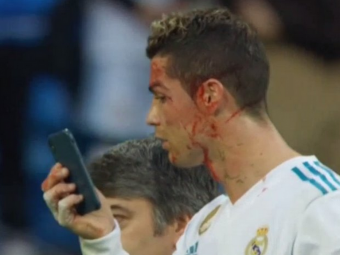 &quot;Noua asa ne-a spus in vestiar&quot; Zidane explica de ce a cerut Ronaldo TELEFONUL dupa ce s-a accidentat
