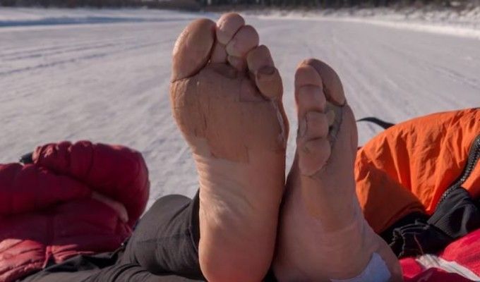 Supereroii nu sunt numai la Hollywood! Tibi Useriu mai are 60 de kilometri pana la linia de sosire a Maratonului Arctic! Cum arata picioarele sale: FOTO_1