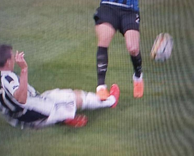 ATENTIE, IMAGINI SOCANTE! Cum arata piciorul lui Mandzukic dupa atacul HORROR din meciul cu Inter_2
