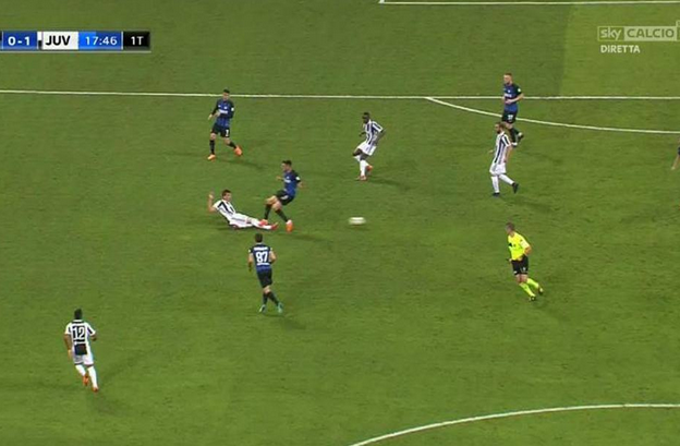 ATENTIE, IMAGINI SOCANTE! Cum arata piciorul lui Mandzukic dupa atacul HORROR din meciul cu Inter_3