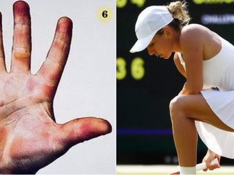 
	Wimbledon 2018. SACRIFICIUL IMENS al jucatorilor de tenis. Cum arata palmele Simonei Halep si ale altor jucatori de top
