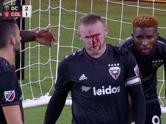 
	VIDEO | Rooney, plin de sange dupa primul sau in MLS! A avut nevoie de cinci copci
