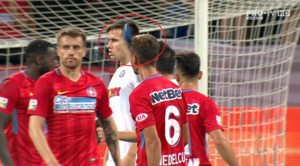 VIDEO | Nedelcu, plin de sange la faza penalty-ului! INCREDIBIL | Jucatorul FCSB, lovit de un scaun aruncat din tribune_2