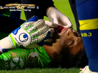 
	I-a SPART dintii portarului cu capul! Incident dramatic in Copa Libertadores! VIDEO
