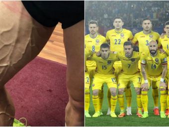 
	Asa arata piciorul unui jucator din nationala Romaniei! Fotbalistul care a rupt Instagramul dupa ce s-a transformat in RONALDO
