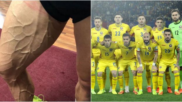 
	Asa arata piciorul unui jucator din nationala Romaniei! Fotbalistul care a rupt Instagramul dupa ce s-a transformat in RONALDO
