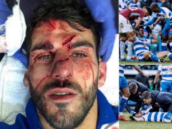 
	IMAGINE DE GROAZA | Un atacant din Championship a fost calcat pe cap de un fundas advers si s-a ales cu rani teribile. MOMENTUL A FOST FILMAT
