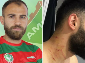 
	ULTIMA ORA | Suspendarea primita de fotbalistul care si-a atacat adversarul CU LAMA pe teren, in Turcia
