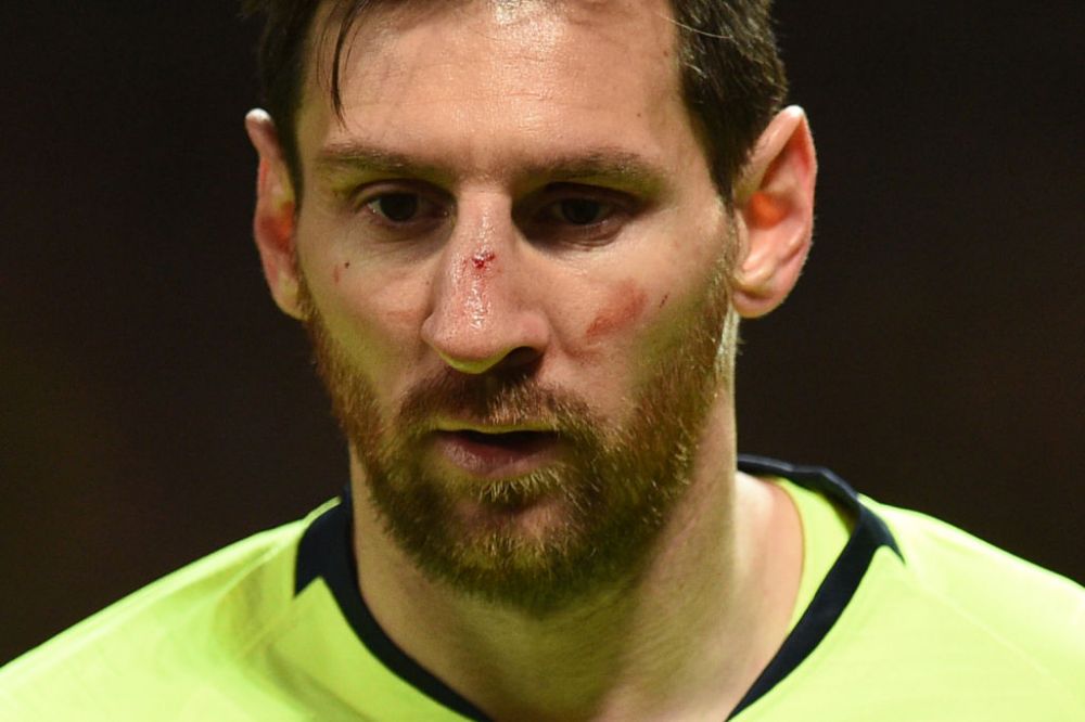 MAN UNITED - BARCELONA 0-1 | Care este starea lui Messi dupa ce a fost umplut de sange pe Old Trafford: "N-a putut sa respire normal tot meciul!"_1