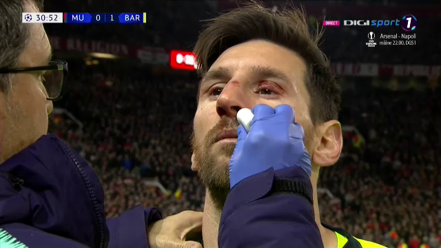 MAN UNITED - BARCELONA 0-1 | Care este starea lui Messi dupa ce a fost umplut de sange pe Old Trafford: "N-a putut sa respire normal tot meciul!"_2