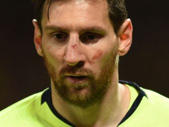 
	MAN UNITED - BARCELONA 0-1 | Care este starea lui Messi dupa ce a fost umplut de sange pe Old Trafford: &quot;N-a putut sa respire normal tot meciul!&quot;
