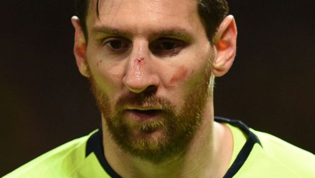 
	MAN UNITED - BARCELONA 0-1 | Care este starea lui Messi dupa ce a fost umplut de sange pe Old Trafford: &quot;N-a putut sa respire normal tot meciul!&quot;
