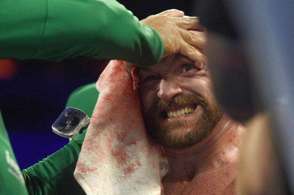 Tyson Fury, meci ULUITOR: si-a invins adversarul cu fata plina de sange si a fost dus la spital. FOTO_5