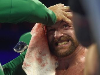 
	Tyson Fury, meci ULUITOR: si-a invins adversarul cu fata plina de sange si a fost dus la spital. FOTO
