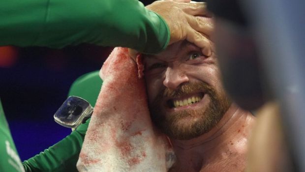 
	Tyson Fury, meci ULUITOR: si-a invins adversarul cu fata plina de sange si a fost dus la spital. FOTO
