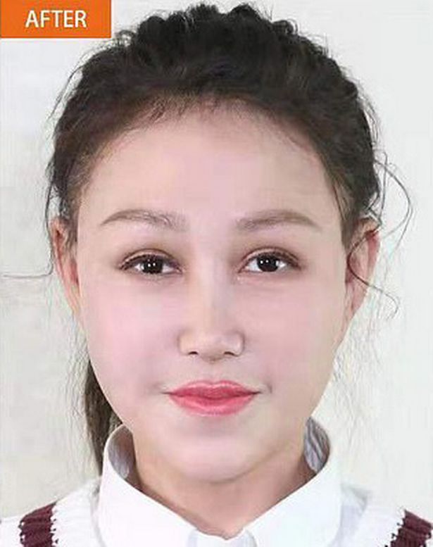 Batjocorita la scoala pentru ca arata batrana din cauza unei boli rare, o fetita din China a primit un transplant de fata! Cum arata acum_2