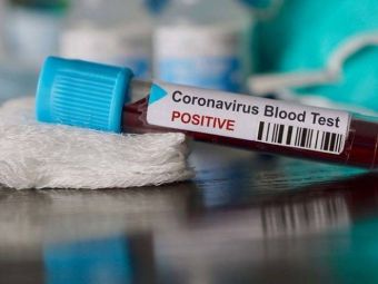 
	Masurile preventive au fost anuntate! Ce iau medicii de la spitalul MAI din Bucuresti pentru a incerca sa se protejeze in fata coronavirusului
