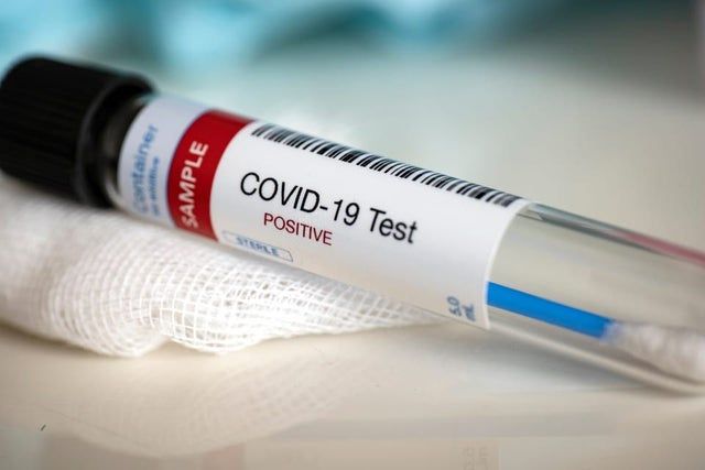 coronavirus virale