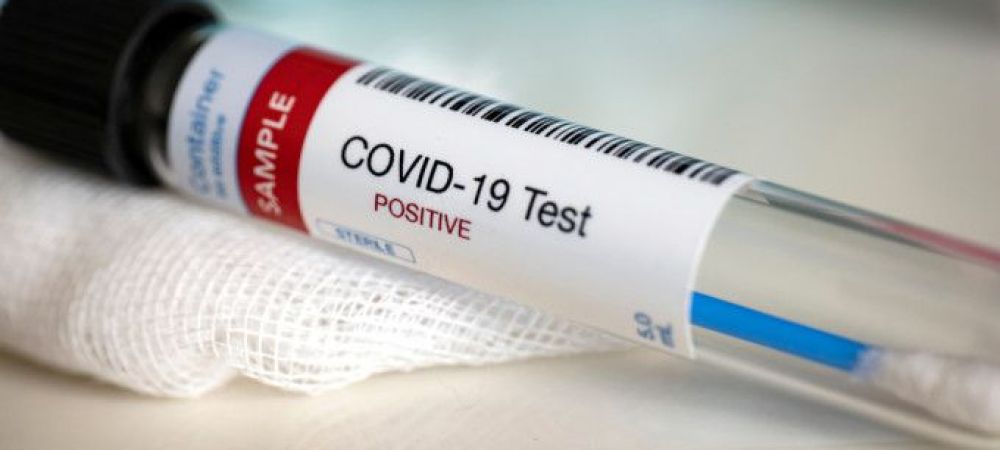 LPF clinica privata teste Covid-19