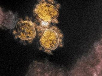 
	A fost descoperita o noua metoda de raspandire a Covid-19! Solutia gasita de cercetatorii din Spania pentru a combate coronavirusul
