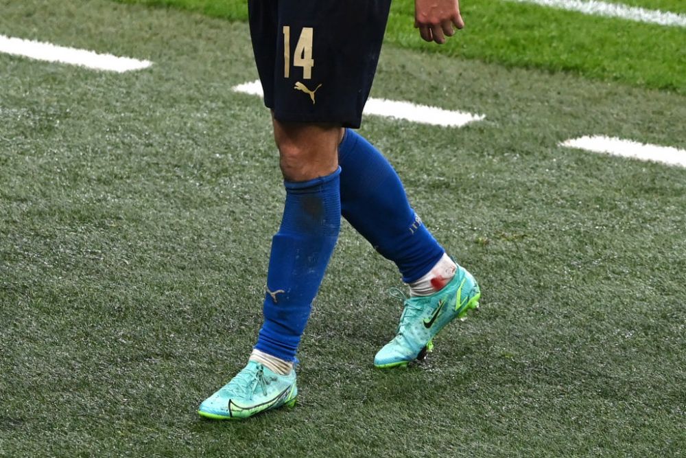 Sacrificiul facut de Federico Chiesa pentru finala EURO 2020. Imaginile cu glezna italianului au impresionat o lume intreaga FOTO_3