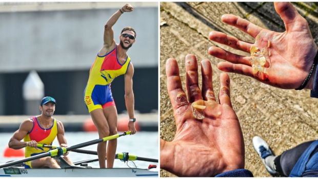 
	Suferințele din spatele unei medalii olimpice | Poza cu palmele lui Ciprian Tudosă, dovada sacrificiilor uriașe
