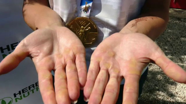 FOTO | Așa arată sacrificiul! Imagini impresionante cu palmele câștigătoarelor probei olimpice de dublu vâsle (P)_1