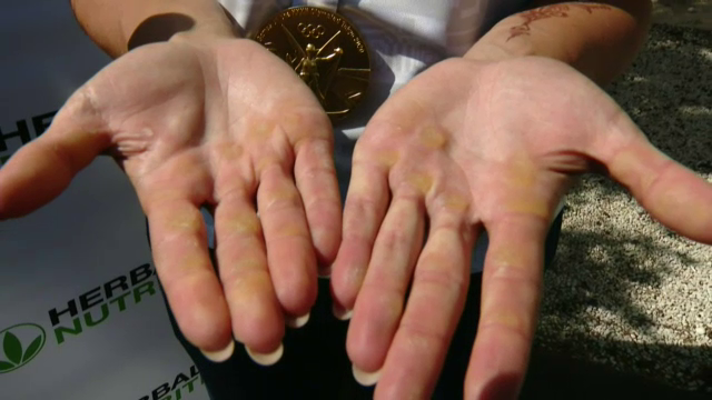 FOTO | Așa arată sacrificiul! Imagini impresionante cu palmele câștigătoarelor probei olimpice de dublu vâsle (P)_2