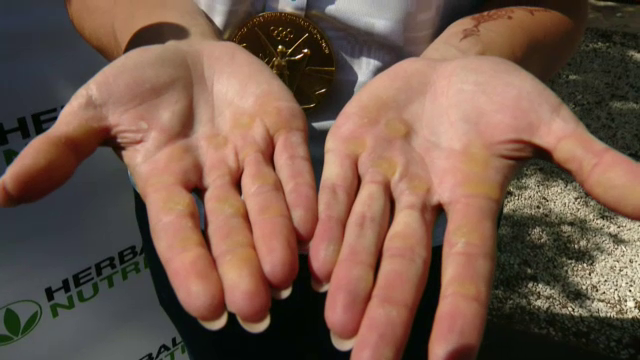 FOTO | Așa arată sacrificiul! Imagini impresionante cu palmele câștigătoarelor probei olimpice de dublu vâsle (P)_3