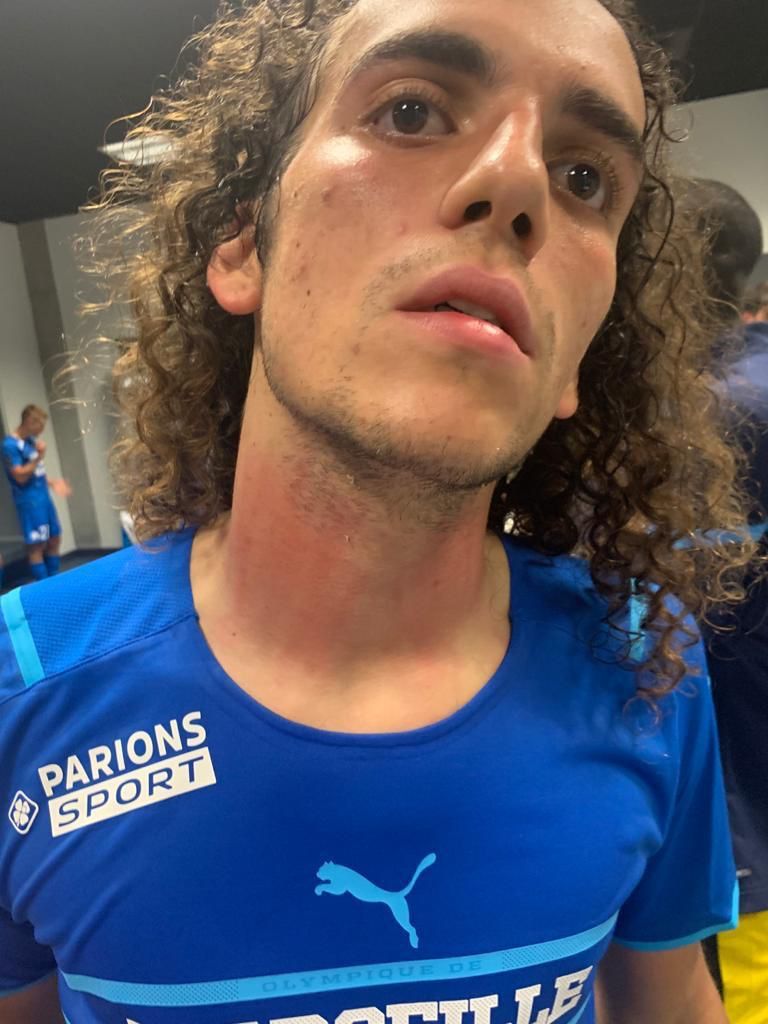 VIDEO | Imagini nebune din Franța! Suporterii lui Nice au pătruns pe teren și i-au bătut pe jucătorii lui OM_1