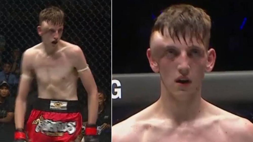 Imagini extrem de dure din MMA! Un luptător s-a ales cu un hematom uriaș în timpul luptei _2