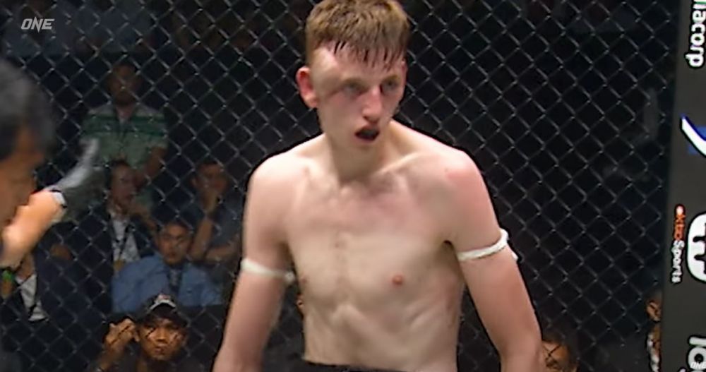 Imagini extrem de dure din MMA! Un luptător s-a ales cu un hematom uriaș în timpul luptei _3