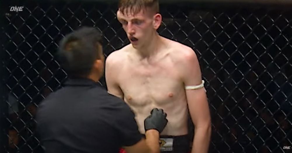 Imagini extrem de dure din MMA! Un luptător s-a ales cu un hematom uriaș în timpul luptei _4