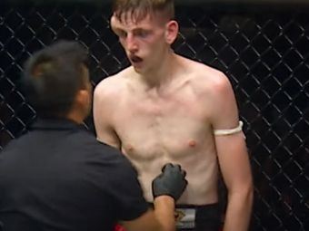 Imagini extrem de dure din MMA! Un luptător s-a ales cu un hematom uriaș în timpul luptei&nbsp;