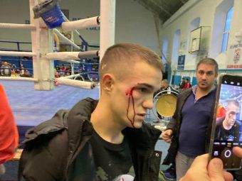 Imagini ireale: un tânăr boxer român, bătut de antrenor după ce a câștigat titlul! Reacția agresorului&nbsp;