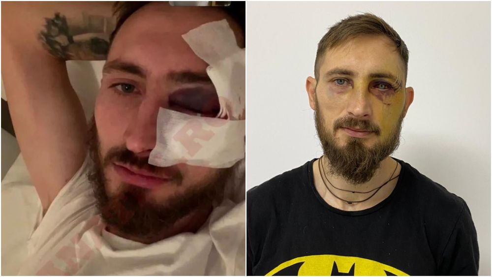Măsura drastică luată de CS Mioveni împotriva lui Dinamo, după ce Eșanu l-a accidentat grav pe Bogdan Rusu_2