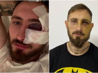 
	Măsura drastică luată de CS Mioveni împotriva lui Dinamo, după ce Eșanu l-a accidentat grav pe Bogdan Rusu
