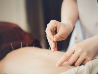 
	Tratament acupunctură ieftină pentru femeile însărcinate (P)
